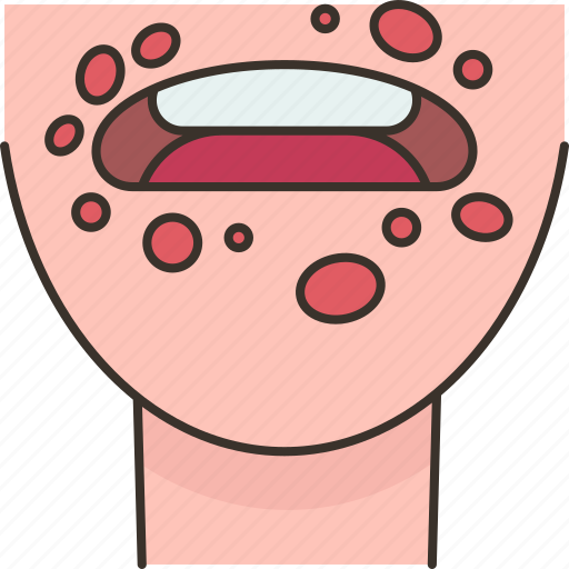 Mouth, disease, blisters, rash, symptom icon - Download on Iconfinder