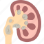 kidney, stone, diagnosis, disease, problem 