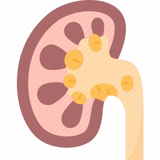 Kidney, stone, disease, infection, health icon - Download on Iconfinder