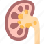 kidney, stone, disease, infection, health 