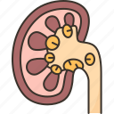 kidney, stone, disease, infection, health