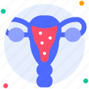 uterus, gynecology, reproductive, ovary, woman, human organ, medical checkup, anatomy, organ