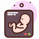 baby, scan, mother, pregnancy