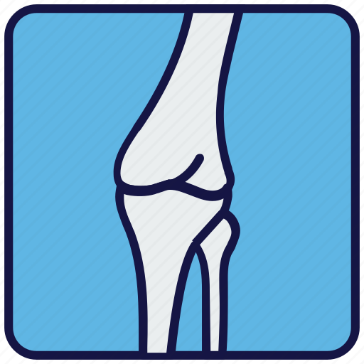Bone, medical, osteoporosis, x-ray icon - Download on Iconfinder