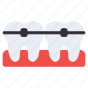 braces, teeth braces, dental care, oral care, dentology 