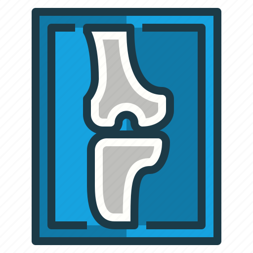Bone, joint, medical, ray, x icon - Download on Iconfinder