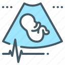 embryo, ultrasound, fetal pulse, fetal