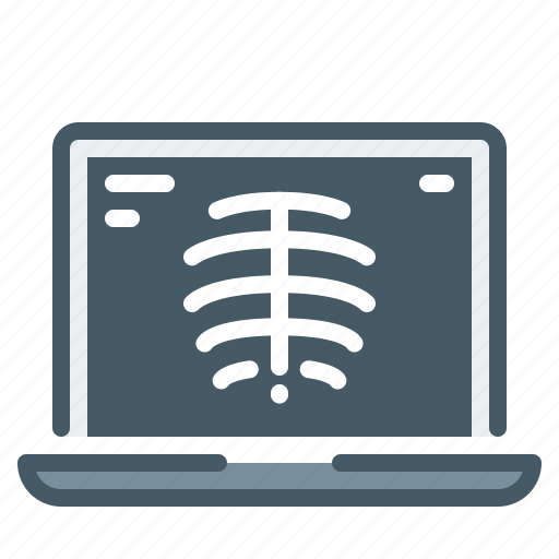 Xray, ray, laptop, x-ray icon - Download on Iconfinder