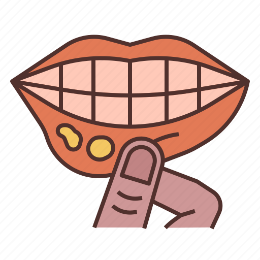 Ulcers, oral, mouth, biting, tooth, mouth sores, mouth ulcer icon - Download on Iconfinder