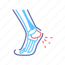 disease, foot, heel, human, orthopedics, pain, skeleton