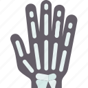 xray, hand, wrist, radiography, bone