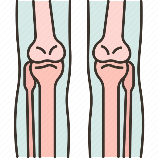 Bone, skeleton, joint, anatomy, orthopedic icon - Download on Iconfinder