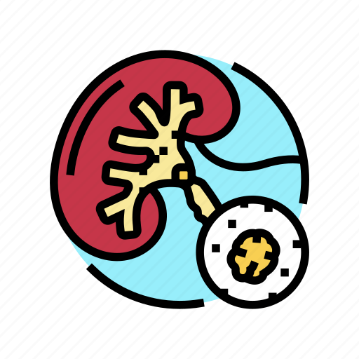 Urolithiasis, urology, prostate, urinary, kidney, bladder icon - Download on Iconfinder