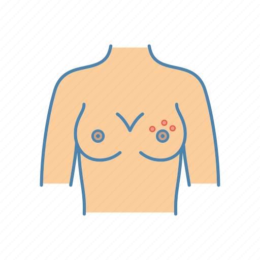Breast rash, dermatitis, dimpling, irritation, itchy, nipple, skin icon - Download on Iconfinder
